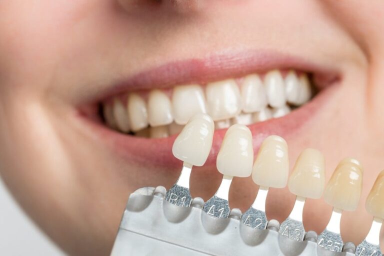 Reveal Your Dazzling Smile: Unleashing the Remarkable Benefits of Porcelain Veneers